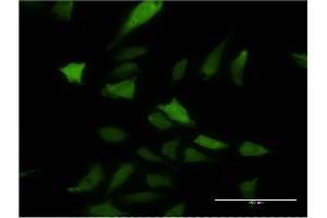 Immunofluorescence of monoclonal antibody to DNAJC3 on HeLa cell. (DNAJC3 antibody  (AA 1-234))