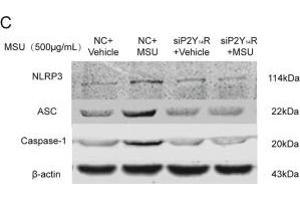 Western Blotting (WB) image for anti-Caspase 1 p20 (AA 181-280) antibody (ABIN5675787)