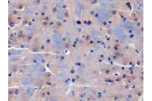 IHC-P analysis of Mouse Cerebrum Tissue, with DAB staining. (CDK18 antibody  (AA 121-402))