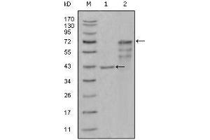 壳三糖苷酶1抗体（AA 22-137）
