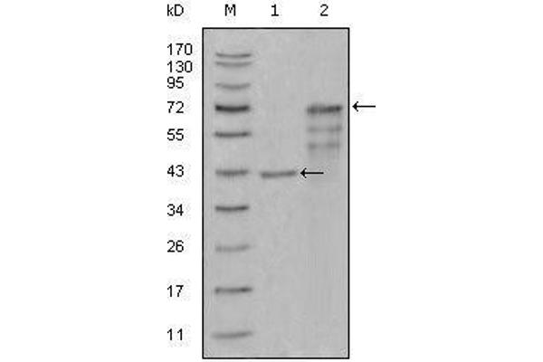 壳三糖苷酶1抗体（AA 22-137）