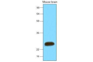 Western Blotting (WB) image for anti-Synaptosomal-Associated Protein, 25kDa (SNAP25) antibody (ABIN306426) (SNAP25 antibody)