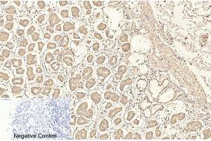 Immunohistochemical analysis of paraffin-embedded human stomach tissue. (CD4 antibody)