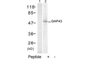 Image no. 2 for anti-Growth Associated Protein 43 (GAP43) (Ser41) antibody (ABIN197546) (GAP43 antibody  (Ser41))