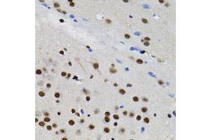 Immunohistochemistry of paraffin-embedded rat brain using GTF2I antibody. (GTF2I antibody)