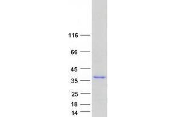 TXNDC5 Protein (Transcript Variant 1) (Myc-DYKDDDDK Tag)