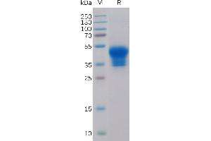 Human IL2RA Protein, His Tag on SDS-PAGE under reducing condition. (CD25 Protein (AA 22-213) (His tag))