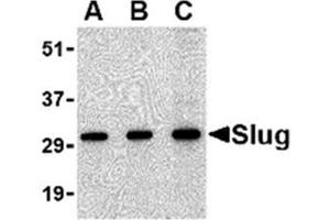 Image no. 1 for anti-Snail Family Zinc Finger 2 (SNAI2) (Middle Region) antibody (ABIN318763) (SLUG antibody  (Middle Region))