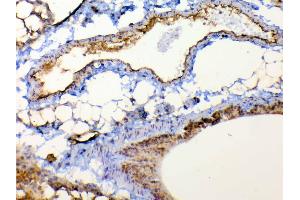 IHC analysis of TSPAN12 using anti-TSPAN12 antibody . (TSPAN12 antibody  (AA 111-224))