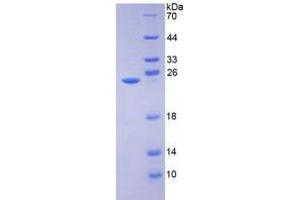 SDS-PAGE analysis of AMBP Protein. (AMBP Protein)