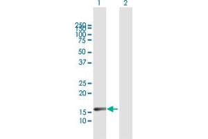 Western Blot analysis of IL20 expression in transfected 293T cell line by IL20 MaxPab polyclonal antibody. (IL-20 antibody  (AA 1-176))