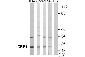 Western Blotting (WB) image for anti-Cysteine and Glycine-Rich Protein 1 (CSRP1) (Internal Region) antibody (ABIN1849240) (CSRP1 antibody  (Internal Region))