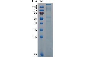 Mouse VWF (23-2813) Protein, His Tag on SDS-PAGE under reducing condition. (VWF Protein (AA 23-2813) (His tag))