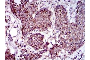 Immunohistochemistry (IHC) image for anti-Mitochondrial Ribosomal Protein L42 (MRPL42) (AA 10-142) antibody (ABIN1724818)