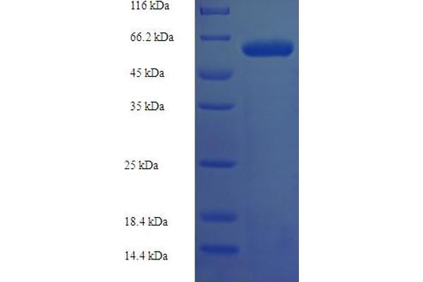 DLK2 Protein (AA 27-306, Extracellular) (GST tag)