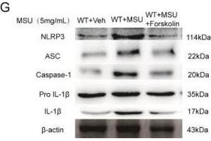 Western Blotting (WB) image for anti-Steroid Sulfatase (STS) antibody (ABIN2170333)