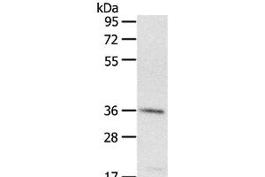 Western Blot analysis of A431 cell using PDLIM4 Polyclonal Antibody at dilution of 1:400 (PDLIM4 antibody)