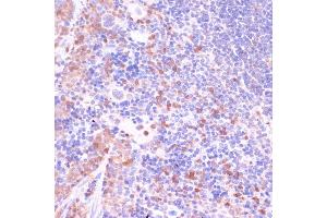 Immunohistochemistry of paraffin-embedded mouse spleen using UGT2B15 antibody (ABIN7271194) at dilution of 1:100 (40x lens). (UGT2B15 antibody  (AA 60-190))