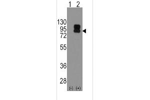 Western blot analysis of CD19 using rabbit polyclonal CD19 Antibody using 293 cell lysates (2 ug/lane) either nontransfected (Lane 1) or transiently transfected with the CD19 gene (Lane 2). (CD19 antibody  (N-Term))