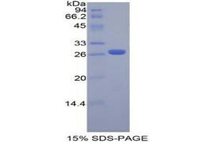 SDS-PAGE analysis of Mouse FGFRL1 Protein. (FGFRL1 Protein)