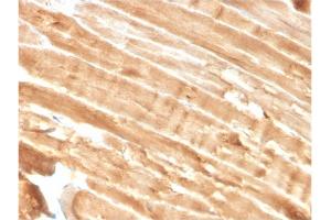 Formalin-fixed, paraffin-embedded human Skeletal Muscle stained with Dystrophin Monospecific Mouse Monoclonal Antibody (DMD/3244). (Dystrophin antibody  (AA 114-263))