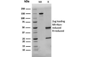 SDS-PAGE Analysis Purified Dystrophin Monospecific Mouse Monoclonal Antibody (DMD/3244). (Dystrophin antibody  (AA 114-263))