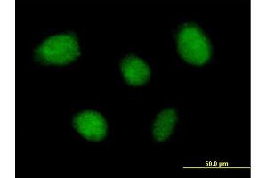 Immunofluorescence of purified MaxPab antibody to TNIP1 on HeLa cell. (TNIP1 antibody  (AA 1-636))