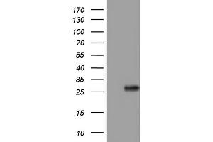 Western Blotting (WB) image for anti-Adiponectin (ADIPOQ) (AA 19-244) antibody (ABIN2715771) (ADIPOQ antibody  (AA 19-244))