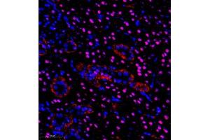 Immunofluorescence of paraffin embedded rat kidney using pax2 (ABIN7074974) at dilution of 1:600 (350x lens) (PAX2A antibody)