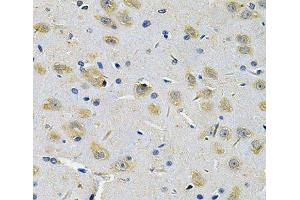 Immunohistochemistry of paraffin-embedded Rat brain using RRAGC Polyclonal Antibody at dilution of 1:100 (40x lens). (GTR2 antibody)