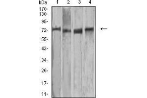 Western blot analysis using MMP2 mouse mAb against MCF-7 (1), Raw264. (MMP2 antibody  (AA 9-140))