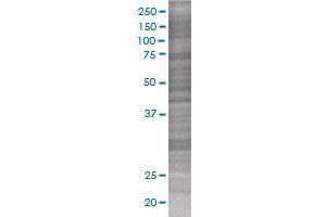 RGS3 transfected lysate. (RGS3 293T Cell Transient Overexpression Lysate(Denatured))