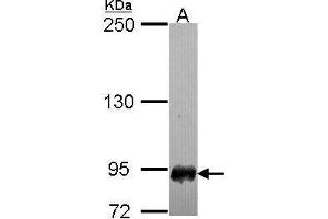 WB Image Sample (30 ug of whole cell lysate) A: IMR32 7. (SFMBT1 antibody  (N-Term))