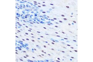 Immunohistochemistry of paraffin-embedded human esophageal using Phospho-ST-S727 Rabbit pAb (ABIN6135319, ABIN6136254, ABIN6136255 and ABIN6225478) at dilution of 1:100 (40x lens). (STAT1 antibody  (pSer727))