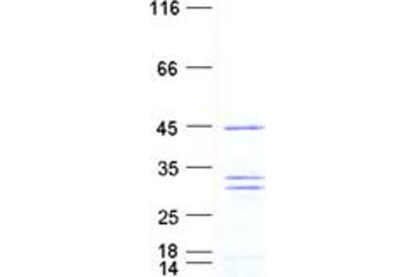 RANBP1 Protein (His tag)