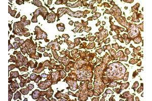 Formalin-fixed, paraffin-embedded human Placenta stained with PLAP Monoclonal Antibody (SPM593). (PLAP antibody)