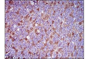 Immunohistochemistry (IHC) image for anti-CD90 (THY1) (AA 17-132) antibody (ABIN1724884)