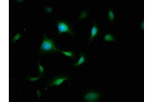 Immunofluorescence staining of U251 cells with ABIN7174025 at 1:200, counter-stained with DAPI. (FYN antibody  (AA 154-270))