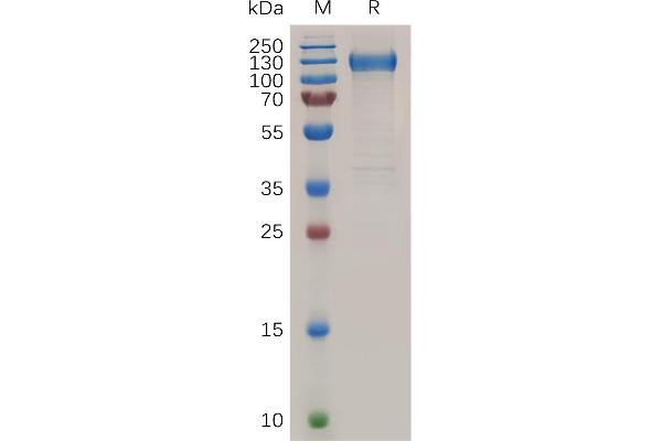 FLT1 Protein (AA 27-756) (His tag)