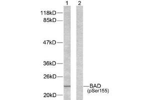 Western blot analysis of extracts from 293 cells using BAD (phospho-Ser155) antibody (E011069) . (BAD antibody  (pSer155))