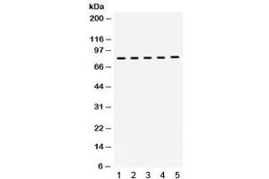 Western blot testing of 1) rat brain, 2) rat testis, 3) mouse brain, 4) mouse testis, 5) human MCF7 lysate with KIF3A antibody. (KIF3A antibody  (AA 485-699))