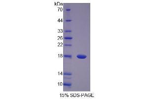 Image no. 1 for Pantothenate Kinase 4 (PANK4) (AA 639-773) protein (His tag) (ABIN4990463) (PANK4 Protein (AA 639-773) (His tag))