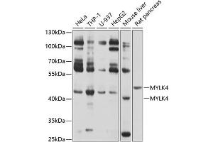 Western blot analysis of extracts of various cell lines, using MYLK4 antibody (ABIN6133126, ABIN6144268, ABIN6144269 and ABIN6214097) at 1:1000 dilution. (MYLK4 antibody  (AA 119-388))