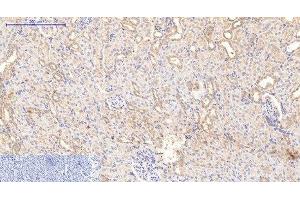 Immunohistochemistry of paraffin-embedded Rat kidney tissue using COL1A1 Monoclonal Antibody at dilution of 1:200. (COL1A1 antibody)