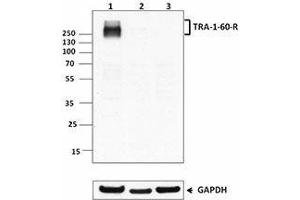 Western Blotting (WB) image for anti-TRA-1-60(R) antibody (ABIN2660534) (TRA-1-60(R) antibody)