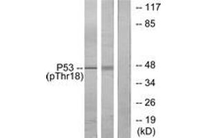 Western blot analysis of extracts from Ovary cancer and K562 cells, using p53 (Phospho-Thr18) Antibody. (p53 antibody  (pThr18))