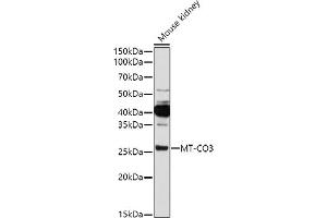 Western blot analysis of extracts of Mouse kidney, using MT-CO3 antibody (ABIN7266635) at 1:1000 dilution. (COX3 antibody)