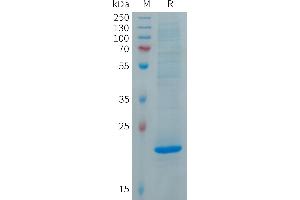 Human Protein, His Tag on SDS-PAGE under reducing condition. (FGF19 Protein (AA 25-216) (His tag))