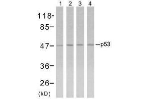 Image no. 1 for anti-Tumor Protein P53 (TP53) (Ser315) antibody (ABIN197254) (p53 antibody  (Ser315))