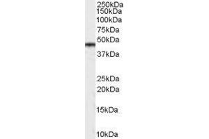 ABIN2561572 (0. (Casein Kinase 1 delta antibody  (Internal Region))